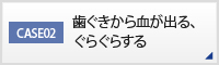 CASE02 歯ぐきから血が出る、ぐらぐらする