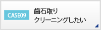 CASE09 歯石取りクリーニングしたい